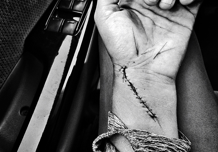 What Self-Harm Is (and Isn’t): Understanding the Struggle